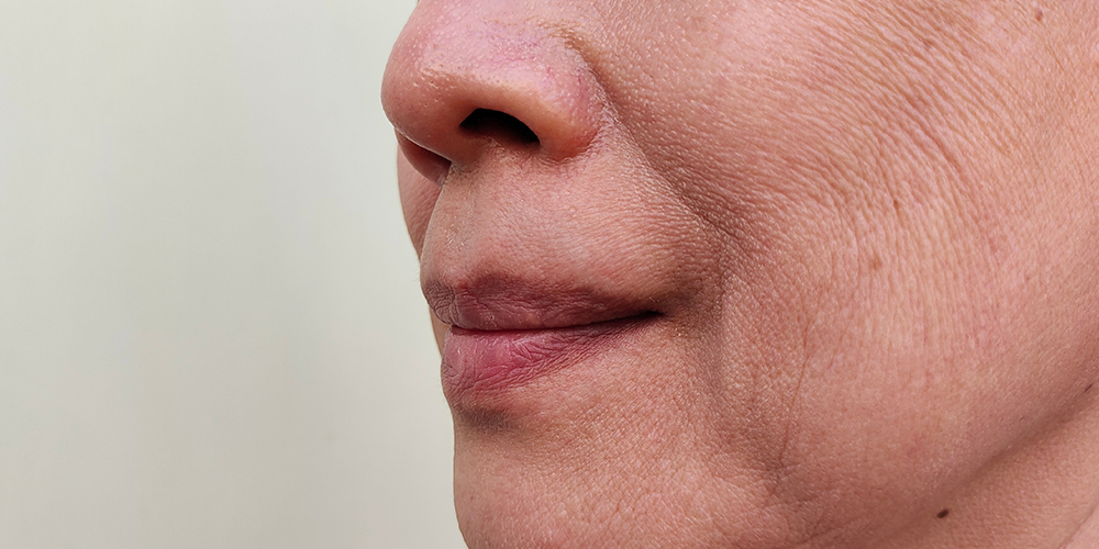 Verslapte, vermoeide huid